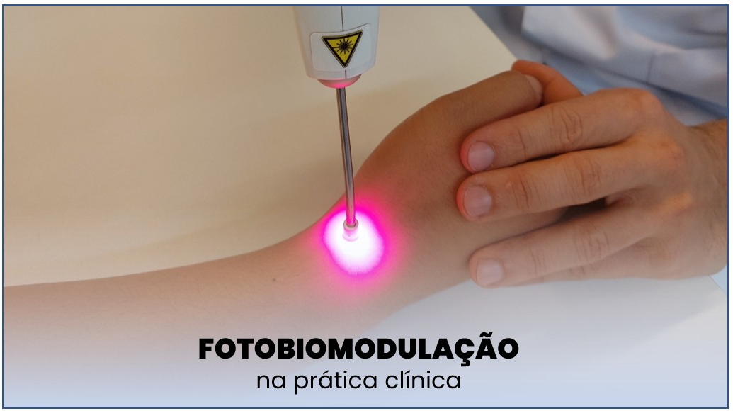 Fotobiomodulação Na Prática Clínica 0630